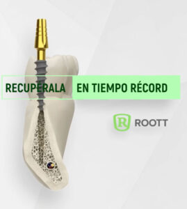 Sistema de implantes ROOTT